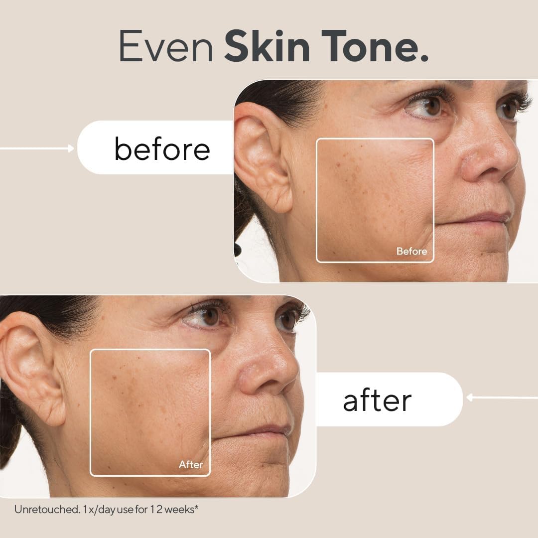 TheraFace Mask (FDA cleared LED skincare mask)