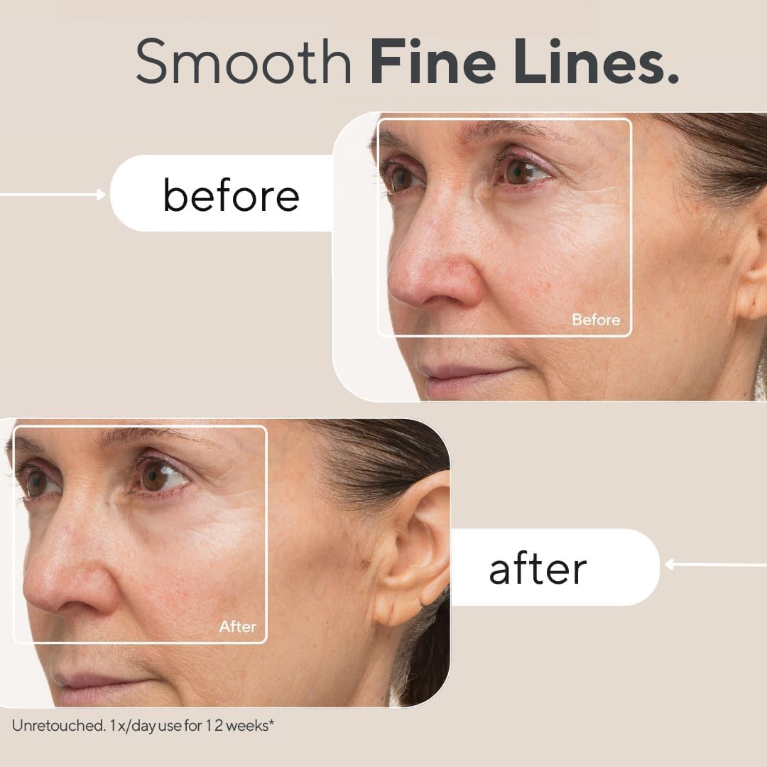TheraFace Mask (FDA cleared LED skincare mask)